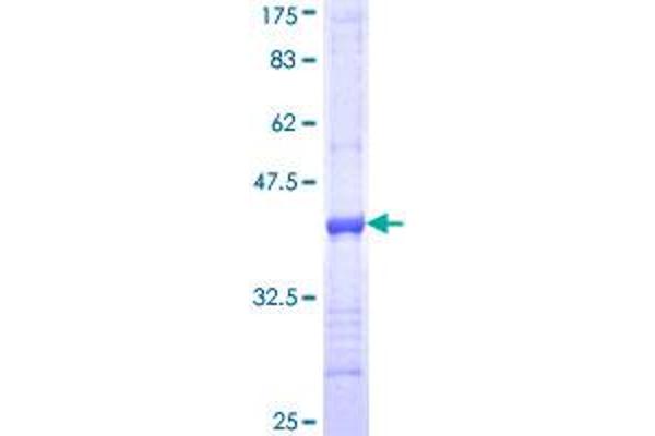 ITGA7 Protein (AA 478-577) (GST tag)