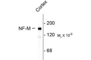 Image no. 1 for anti-Neurofilament Triplet M Protein (NEFM) (C-Term) antibody (ABIN372674)