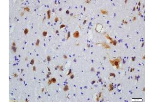 Immunohistochemistry (Paraffin-embedded Sections) (IHC (p)) image for anti-Roundabout, Axon Guidance Receptor, Homolog 4 (ROBO4) (AA 261-360) antibody (ABIN714866)