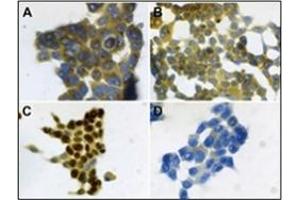 Immunohistochemistry (IHC) image for anti-S100 Calcium Binding Protein A7 (S100A7) antibody (ABIN400722) (S100A7 Antikörper)