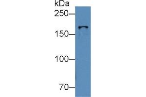 Western Blotting (WB) image for anti-Topoisomerase (DNA) II beta 180kDa (TOP2B) (AA 446-655) antibody (ABIN7440122)