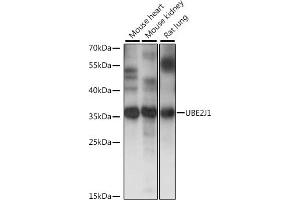 Western blot analysis of extracts of various cell lines, using UBE2J1 antibody (ABIN7271172) at 1:1000 dilution. (UBE2J1 Antikörper  (AA 1-100))