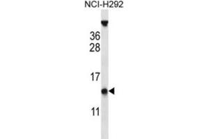 Western Blotting (WB) image for anti-PYD (Pyrin Domain) Containing 1 (PYDC1) antibody (ABIN2997157) (PYDC1 Antikörper)