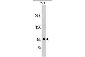Western blot analysis of anti-PDGFRB Pab in Y79 cell line lysates (35ug/lane). (PDGFRB Antikörper)