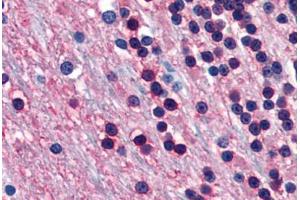 Human Brain, Cerebellum (formalin-fixed, paraffin-embedded) stained with ENO2 antibody ABIN364284 at 20 ug/ml followed by biotinylated anti-mouse IgG secondary antibody ABIN481714, alkaline phosphatase-streptavidin and chromogen. (ENO2/NSE Antikörper)