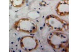 Used in DAB staining on fromalin fixed paraffin-embedded Kidney tissue (BMPR2 Antikörper  (AA 27-150))