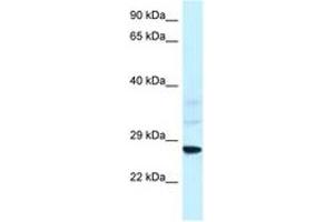 Image no. 1 for anti-Vacuolar-sorting Protein SNF8 (SNF8) (AA 25-74) antibody (ABIN6747424) (SNF8 Antikörper  (AA 25-74))