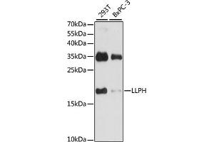 Western blot analysis of extracts of various cell lines, using LLPH antibody (ABIN7268290) at 1:1000 dilution.