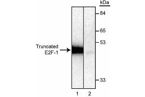 Detection of in vitro translated, [35S] methionine-labeled, truncated E2F-1 protein by immunoprecipitation using KH95/E2F (ABIN967439). (E2F1 Antikörper)
