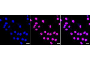 Immunocytochemical staining of HepG2 cells with Phospho-mTOR (S) antibody (ABIN7799349), 1:1,000). (Rekombinanter MTOR Antikörper  (pSer2481))