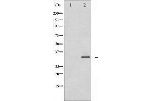 Western blot analysis of Caspase 3 phosphorylation expression in Etoposide treated Jurkat whole cell lysates,The lane on the left is treated with the antigen-specific peptide. (Caspase 3 Antikörper  (pSer150))