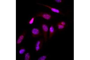 Immunofluorescence (IF) image for anti-Small Ubiquitin Related Modifier 2 (SUMO2) (AA 1-93), (N-Term) antibody (ABIN492386) (SUMO2 Antikörper  (N-Term))