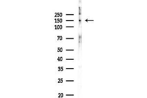 anti-STE20-Like Kinase (SLK) (C-Term) antibody