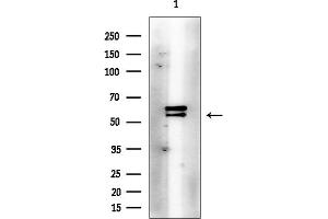 Western blot analysis of lysates from EC304 cells(heat-shock treatment), using Phospho-Lck (Tyr505) Antibody at 1/1000 dilution.