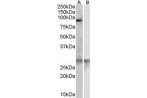Image no. 1 for anti-Acetyl LDL Receptor (SCARF1) (Internal Region) antibody (ABIN374467) (SCARF1 Antikörper  (Internal Region))