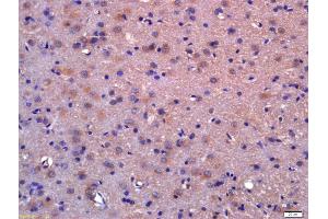 Formalin-fixed and paraffin embedded rat brain labeled with Anti-LDOC1/BCUR1 Polyclonal Antibody, Unconjugated (ABIN717836) at 1:200 followed by conjugation to the secondary antibody and DAB staining (LDOC1 Antikörper  (AA 65-146))