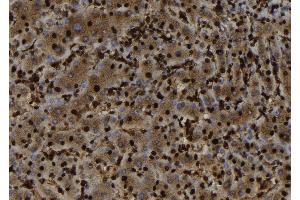 ABIN6279817 at 1/100 staining Human liver tissue by IHC-P. (SH3BGRL Antikörper  (Internal Region))