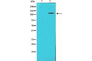 Western blot analysis of CD130/gp130 expression in Jurkat whole cell lysates,The lane on the left is treated with the antigen-specific peptide. (CD130/gp130 Antikörper  (C-Term))