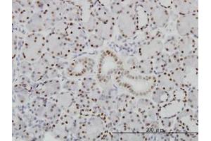 Image no. 1 for anti-Pre-B-Cell Leukemia Homeobox Protein 1 (PBX1) (AA 213-322) antibody (ABIN598855) (PBX1 Antikörper  (AA 213-322))
