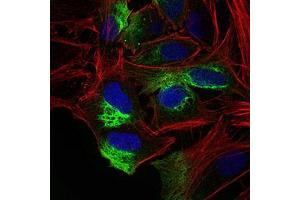 Immunofluorescence analysis of Hela cells using ZEB1 mouse mAb (green). (ZEB1 Antikörper  (AA 967-1108))