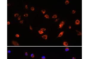 Immunofluorescence analysis of L929 cells using ARL13B Polyclonal Antibody at dilution of 1:100. (ARL13B Antikörper)