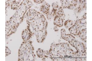 Immunoperoxidase of monoclonal antibody to UBTF on formalin-fixed paraffin-embedded human placenta. (UBTF Antikörper  (AA 551-650))