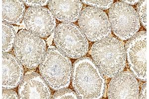 ABIN6265713 and ABIN6272897 at 1/100 staining Rat testis tissue by IHC-P. (TAGLN2 Antikörper  (Internal Region))