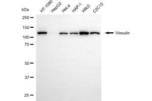 Western blotting analysis using vinculin antibody (ABIN7800841).
