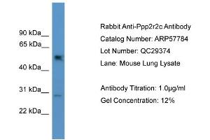 Western Blotting (WB) image for anti-Protein Phosphatase 2, Regulatory Subunit B, gamma (PPP2R2C) (N-Term) antibody (ABIN2787392)