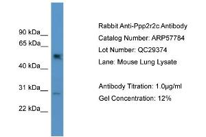 WB Suggested Anti-Ppp2r2c  Antibody Titration: 0.