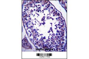 SLC27A3 Antibody immunohistochemistry analysis in formalin fixed and paraffin embedded human testis tissue followed by peroxidase conjugation of the secondary antibody and DAB staining. (SLC27A3 Antikörper  (N-Term))