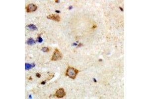 Immunohistochemical analysis of TRAF6 staining in human brain formalin fixed paraffin embedded tissue section. (TRAF6 Antikörper)