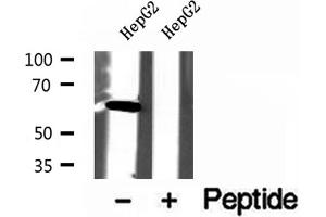 Western blot analysis of extracts of HepG2 cells, using USP39 antibody. (USP39 Antikörper  (N-Term))