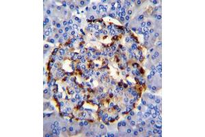 Immunohistochemistry (IHC) image for anti-Phospholipase A2, Group IID (PLA2G2D) antibody (ABIN2996055)