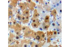 Used in DAB staining on fromalin fixed paraffin-embedded Liver tissue (FOXO1 Antikörper  (AA 222-469))