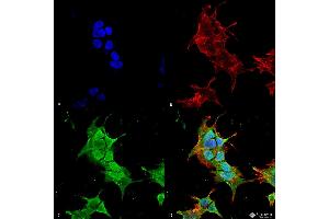 Immunocytochemistry/Immunofluorescence analysis using Mouse Anti-Ankyrin R Monoclonal Antibody, Clone S388A-10 . (Erythrocyte Ankyrin Antikörper  (AA 1-1881) (Biotin))