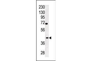 TPST2 Antikörper  (C-Term)