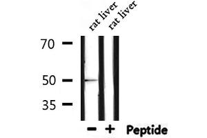 Western blot analysis of extracts from rat brain, using GFAP Antibody.