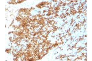 Immunohistochemical staining (Formalin-fixed paraffin-embedded sections) of human tonsil with CD45RB recombinant monoclonal antibody, clone PTPRC/1783R . (Rekombinanter CD45 Antikörper)