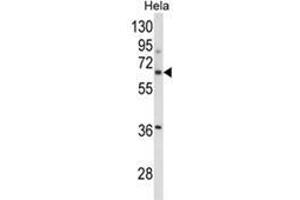 Western blot analysis of ITGBL1 Antibody (Center) in Hela cell line lysates (35ug/lane). (ITGBL1 Antikörper  (Middle Region))