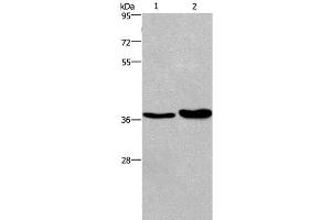 Western Blot analysis of Human testis tissue and transitional cell carcinoma of bladder tissue using FUT1 Polyclonal Antibody at dilution of 1:250 (FUT1 Antikörper)