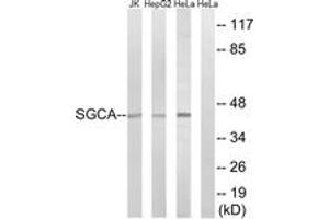 Western Blotting (WB) image for anti-Sarcoglycan, alpha (50kDa Dystrophin-Associated Glycoprotein) (SGCA) (AA 161-210) antibody (ABIN2890111) (SGCA Antikörper  (AA 161-210))