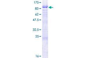BIRC2 Protein (AA 1-618) (GST tag)