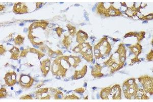 Immunohistochemistry of paraffin-embedded Human stomach using VAPA Polyclonal Antibody at dilution of 1:100 (40x lens). (VAPA Antikörper)