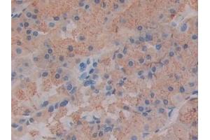 Immunohistochemistry (IHC) image for anti-Slit Homolog 1 (SLIT1) (AA 603-773) antibody (ABIN7438100)