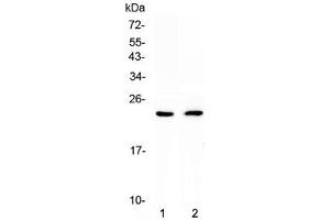 Western blot testing of 1) rat heart and 2) mouse heart lysate with FNDC5 antibody at 0.