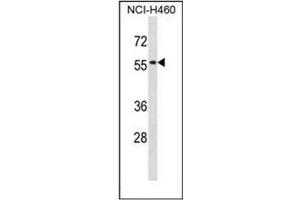 Western blot analysis of CD170 / SIGLEC5 Antibody  in NCI-H460 cell line lysates (35ug/lane). (SIGLEC5 Antikörper  (N-Term))