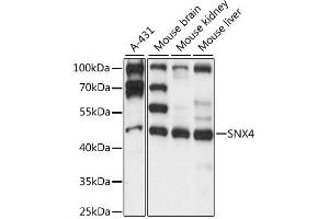 Western blot analysis of extracts of various cell lines, using SNX4 antibody (ABIN6291214) at 1:1000 dilution. (Sorting Nexin 4 Antikörper)