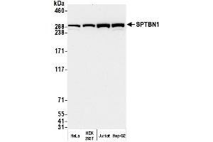 Western Blotting (WB) image for anti-Spectrin Beta, Non-Erythrocytic 1 (SPTBN1) (AA 2100-2150) antibody (ABIN7454694) (SPTBN1 Antikörper  (AA 2100-2150))