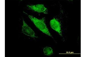 Immunofluorescence of purified MaxPab antibody to GSTK1 on HeLa cell.